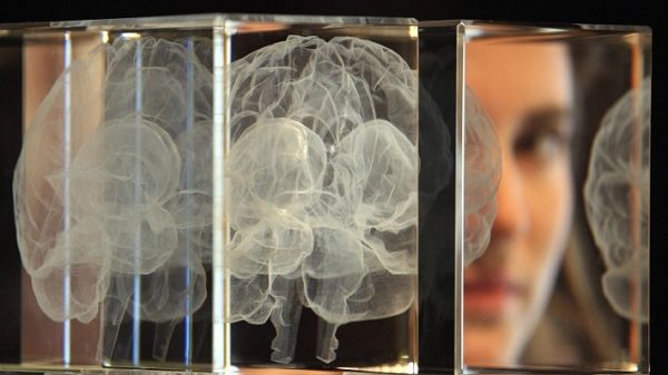 AI brain scans to detect Alzheimer’s