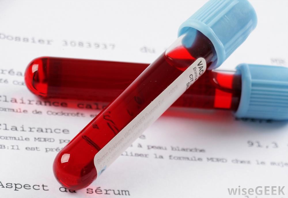 Click to enlarge blood vials, blood testing