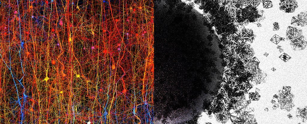 Human brain network