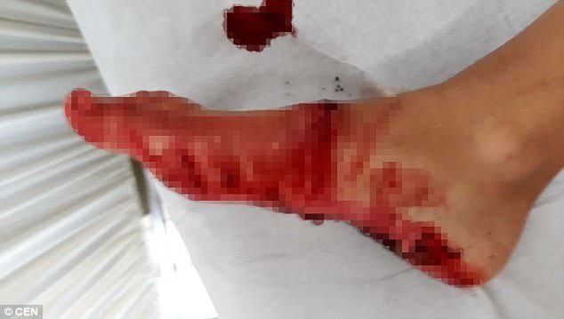 It is not clear whether a shark is responsible for the boy's injuries, but it is well known that various shark species including hammerheads, makos and bull sharks are to be found off Gran Canaria
