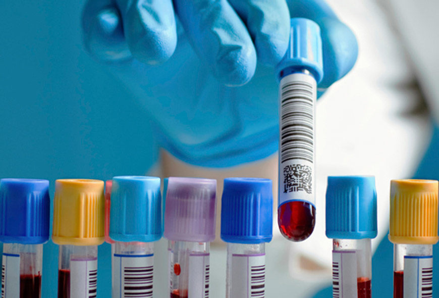 STD infection