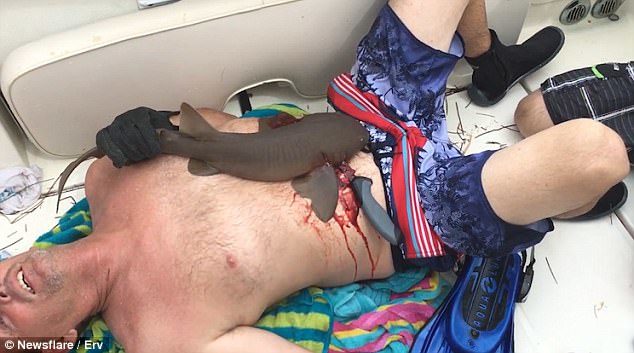 Click to enlarge His friends on the boat are heard making jokes and trying to make him laugh while he lies in pain, trying to get the shark off his stomach