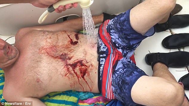 Click to enlarge Mr Maccarty gets a hose down after the shark finally lets go of his stomach. It was a genuinely terrifying experience, where he thought that he was going to drown