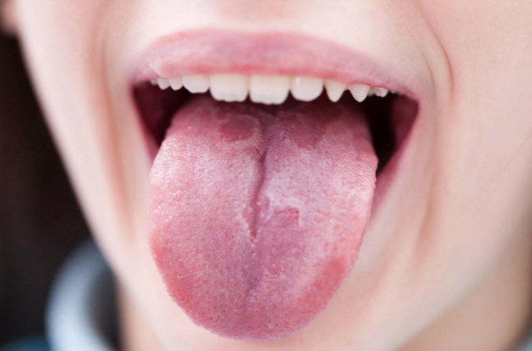 Click to enlarge tongue health