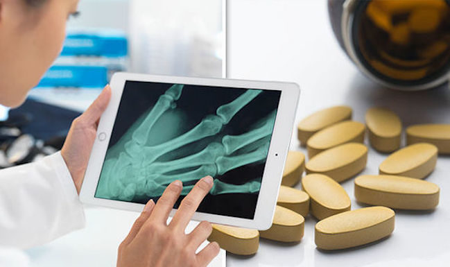 An arthritis pill disable bone loss and damage