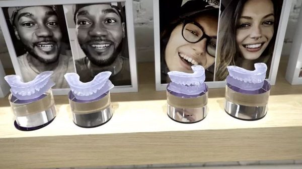 dental impressions