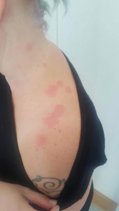 bedbugs British Airways