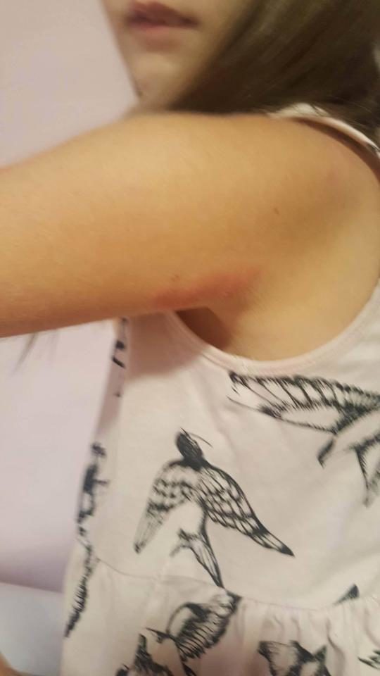 bedbugs british airways