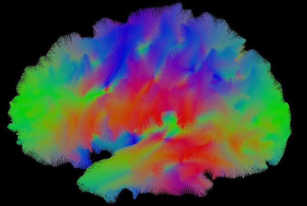 Click to enlarge hallucinations charles bonnet syndrome