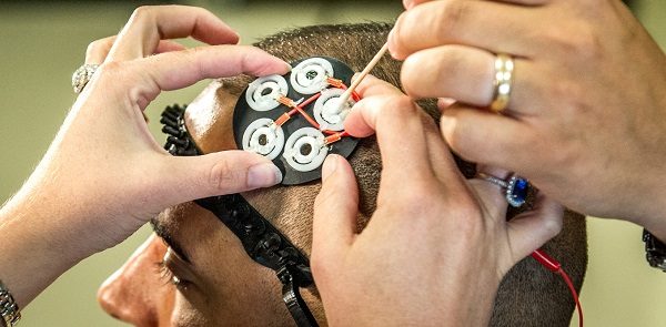Electrically stimulating the brain