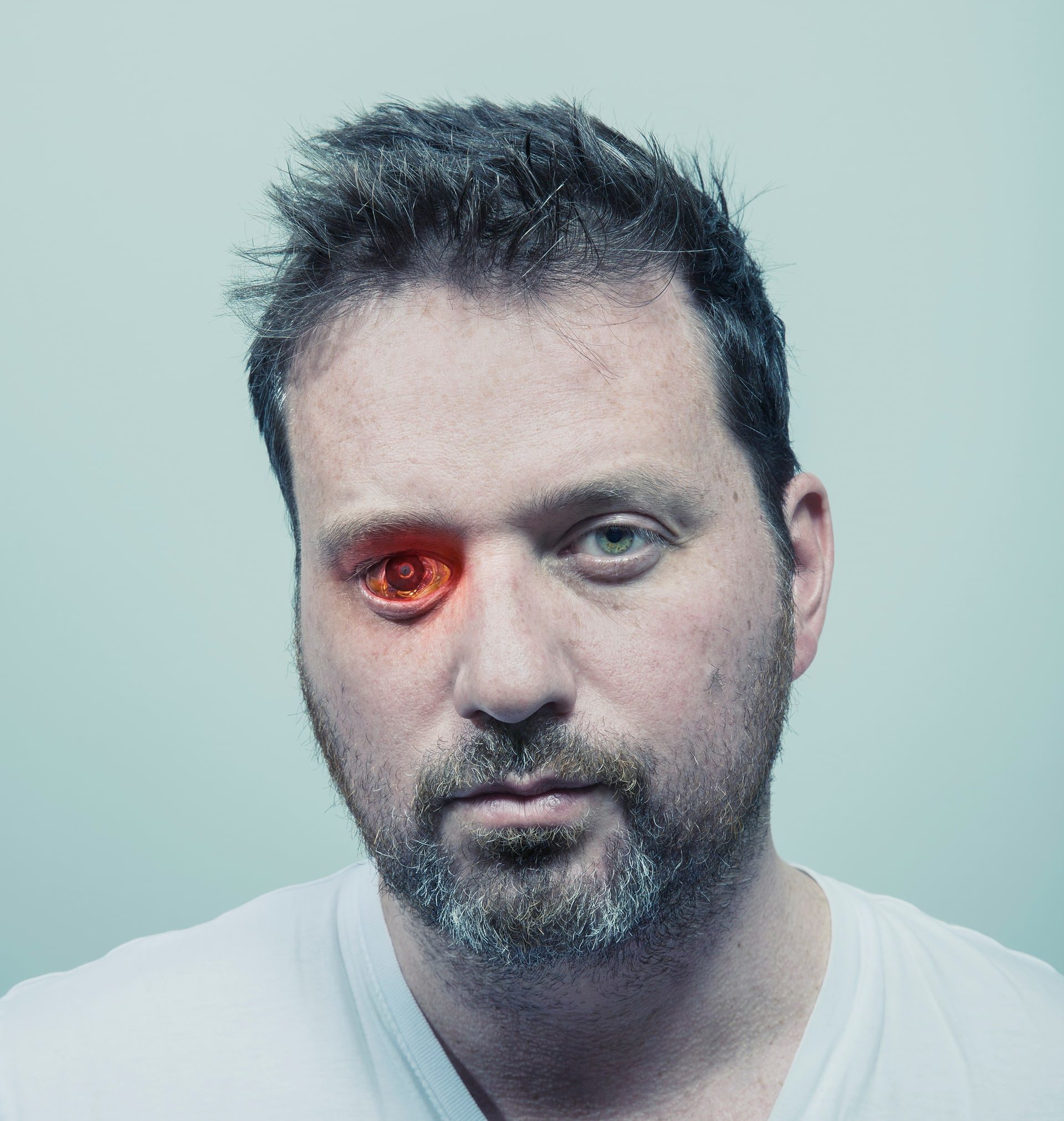 Rob Spence