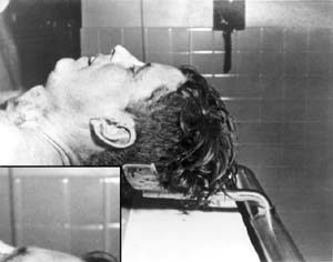 Click to enlarge JFK autopsy