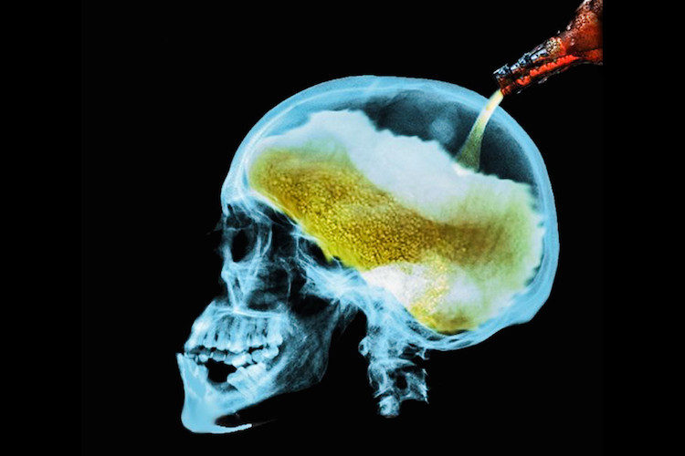 Click to enlarge beer brain