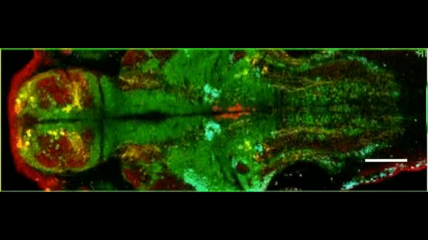 Brain circuitry alertness