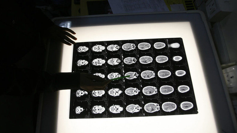 Brain scan