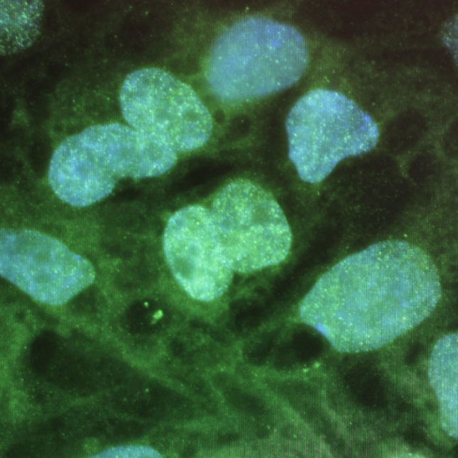 Stem cells