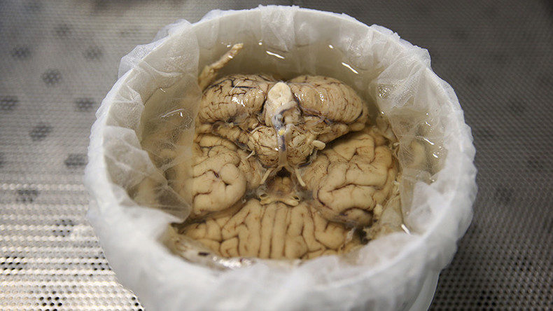 Click to enlarge human brain