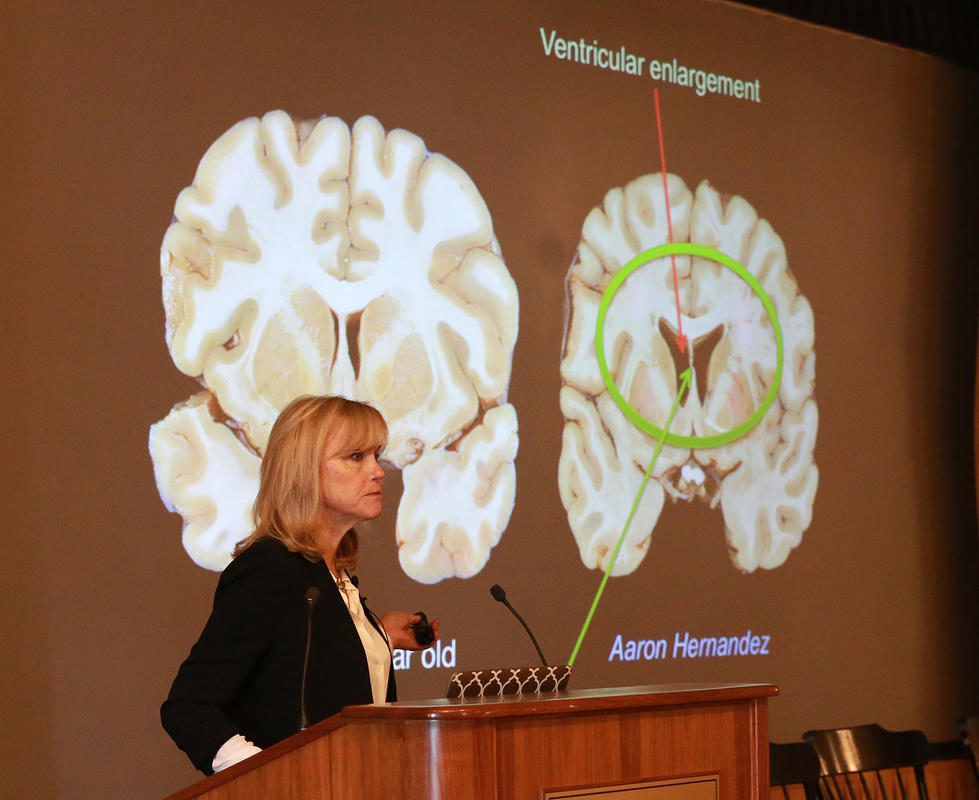 Click to enlarge aaron hernandez postmortem brain