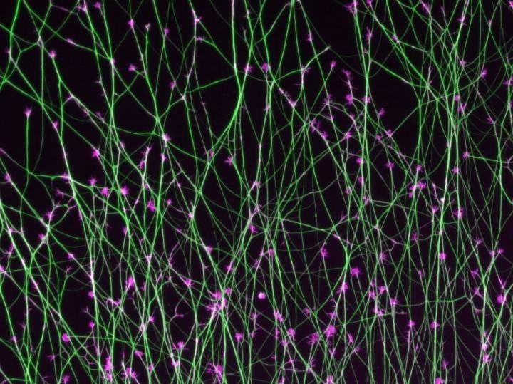 Embryonal brain development