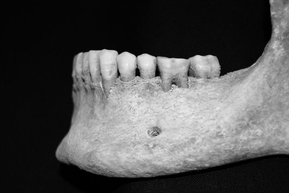 Click to enlarge mandible teeth