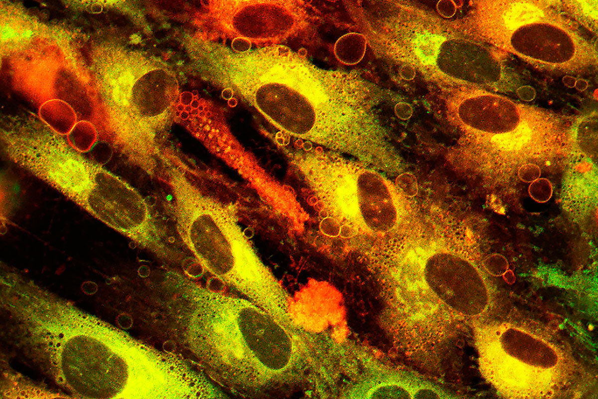 body cells