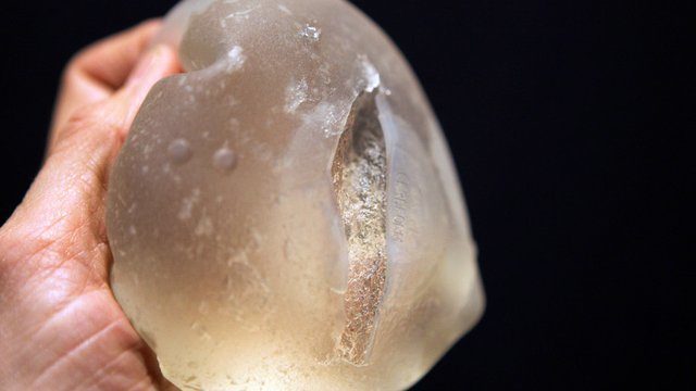 burst breast implant