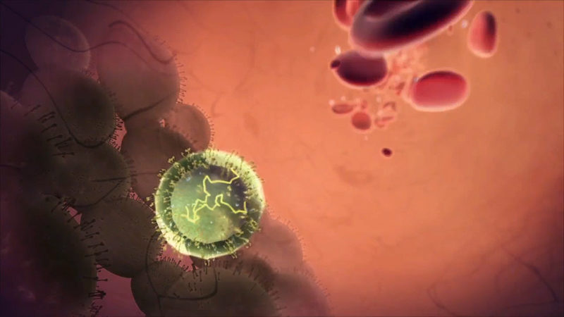 Type 1 Diabetes