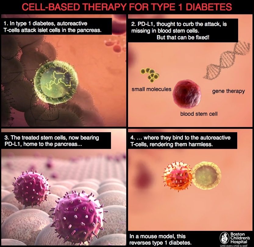 Click to enlarge therapies type 1 diabetes