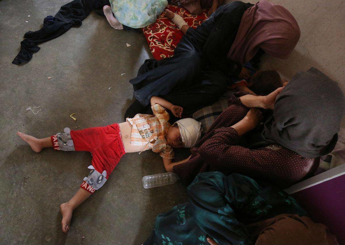 Click to enlarge injured child Iraq Irak niño herido