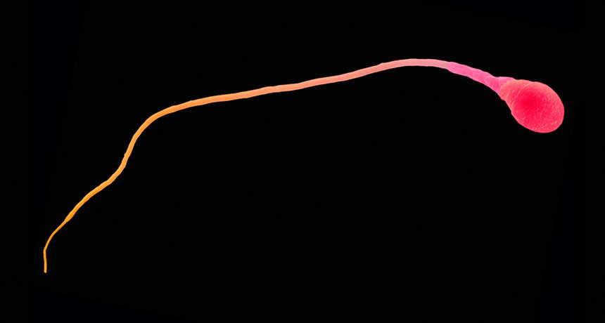 Click to enlarge Sperm