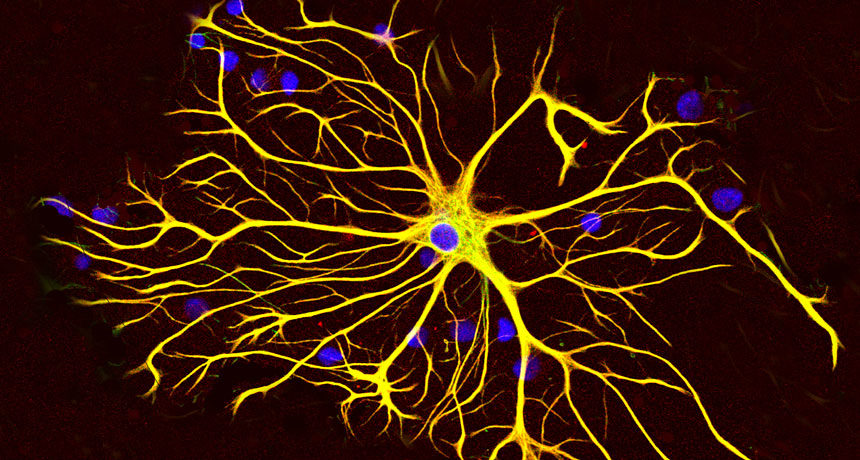 astrocyte  brain cell