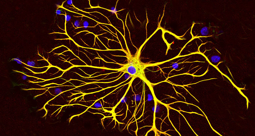 Click to enlarge astrocyte brain cell