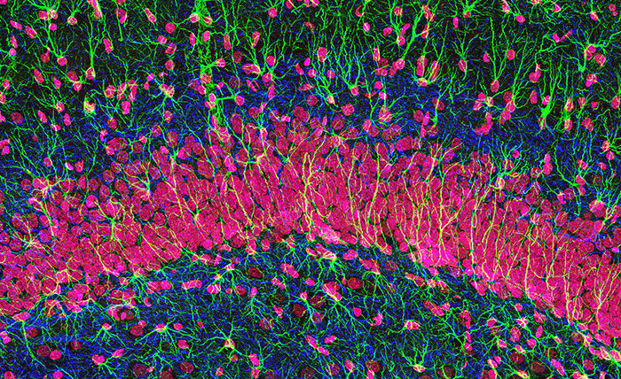 Click to enlarge nerve cells