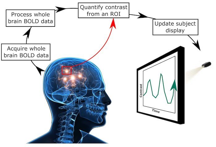 Click to enlarge neurofeedback chart