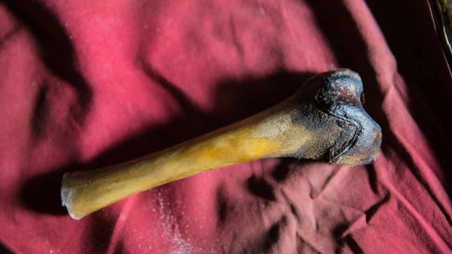 Bone
