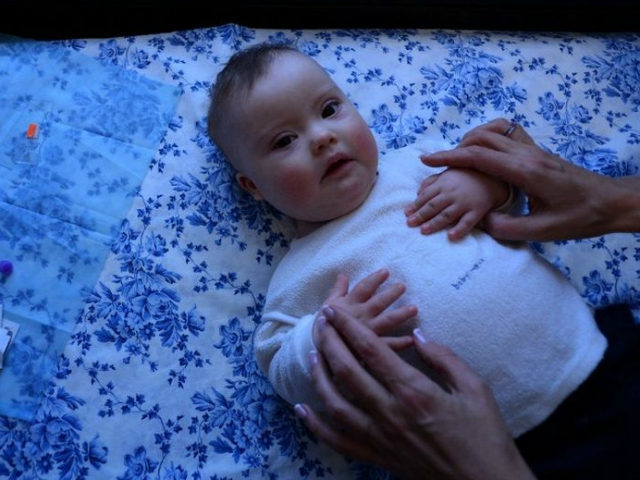 Click to enlarge baby down's syndrome