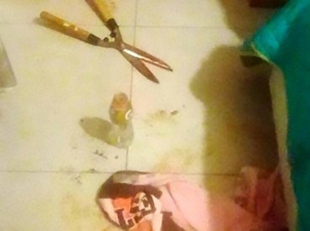 Click to enlarge garden shears to chop off her boyfriend’s penis