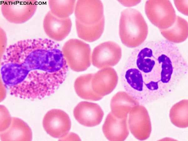 Neutrophil and eosophil