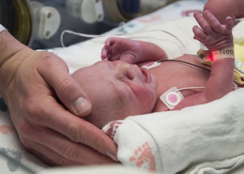 In this undated photo provided by Baylor University Medical Center the first baby born as a result of a womb transplant in the United States lies in the neonatal unit at Baylor University Medical Center in Dallas.