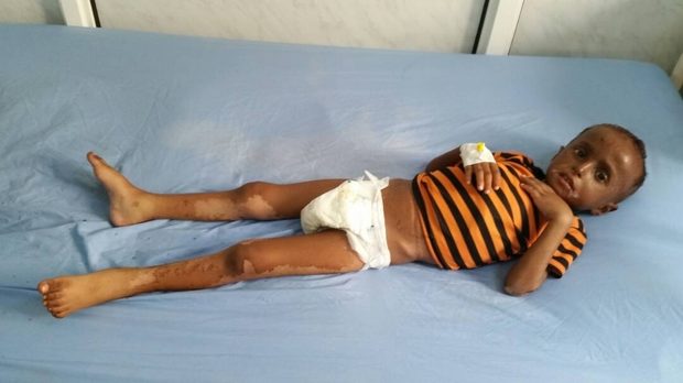Click to enlarge Yemen Siege saudi arabia