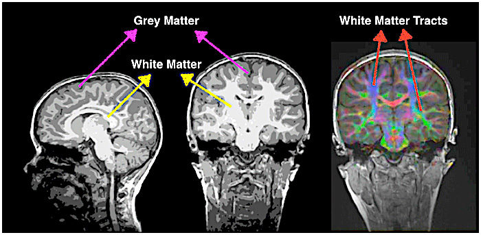Click to enlarge brains