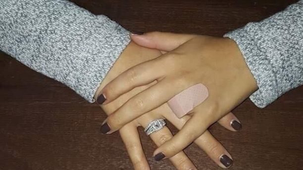 Click to enlarge missing finger