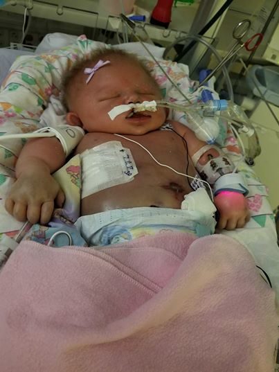 infant meningitis HSV-1