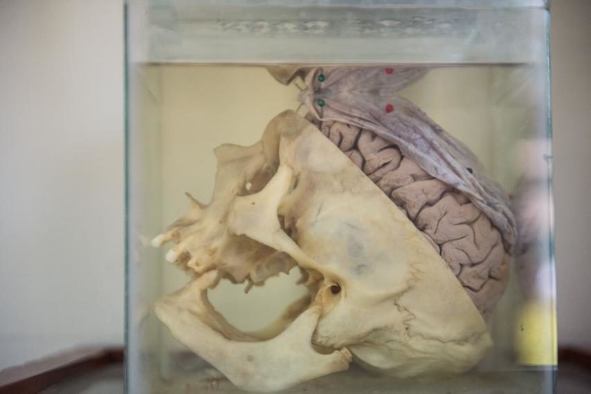 Click to enlarge human skull brain