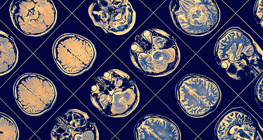 Brain scans