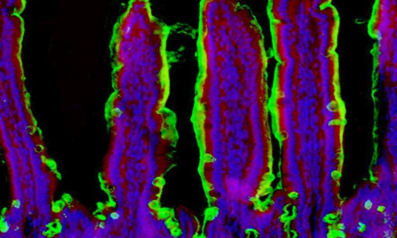 Click to enlarge food poisoning gut bacteria