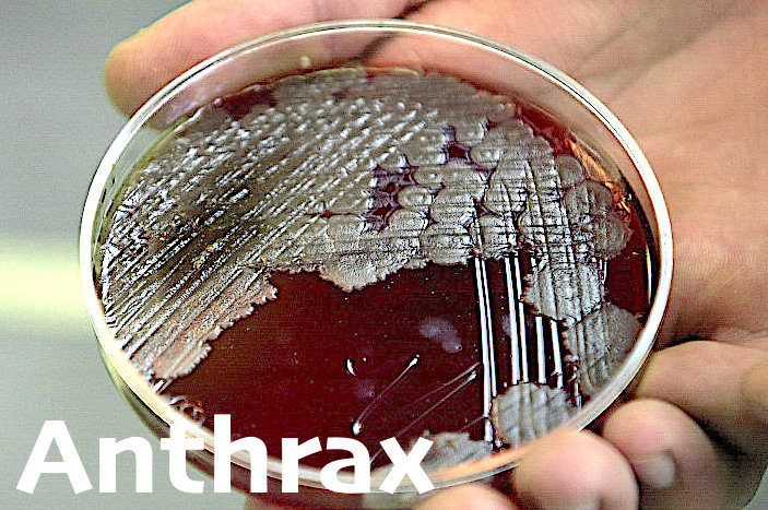 petri dish