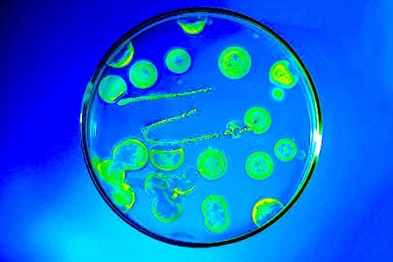 Click to enlarge Necrotizing bacteria