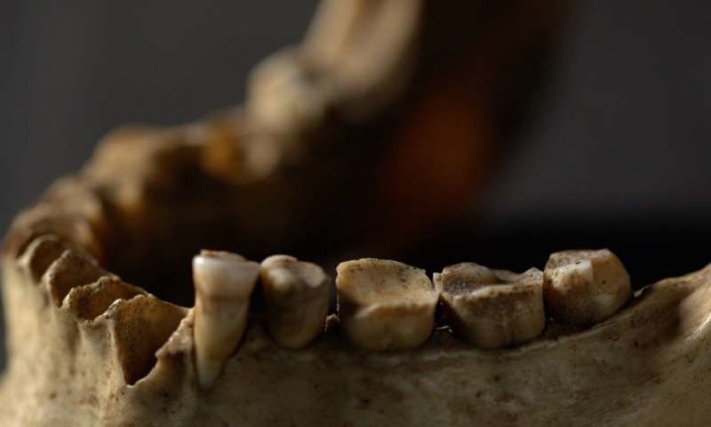 Click to enlarge teeth and jawbone