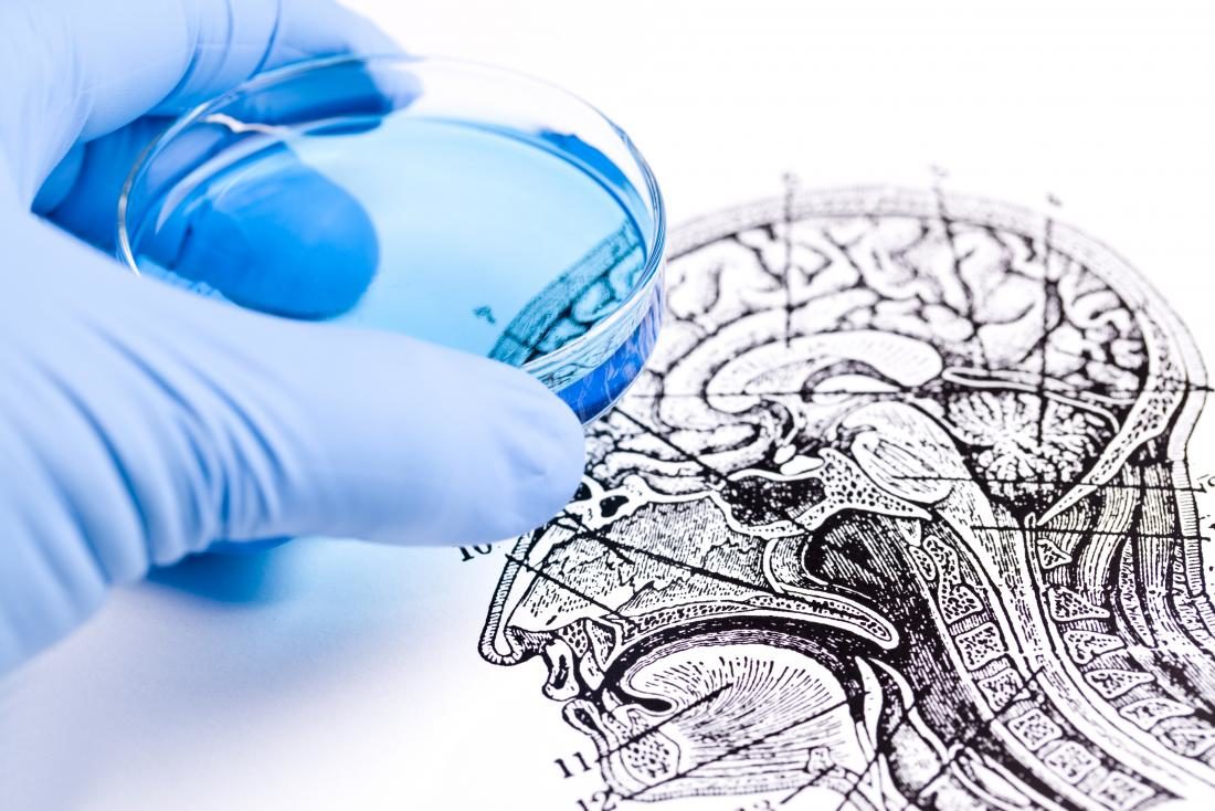 Click to enlarge virus kills brain tumors